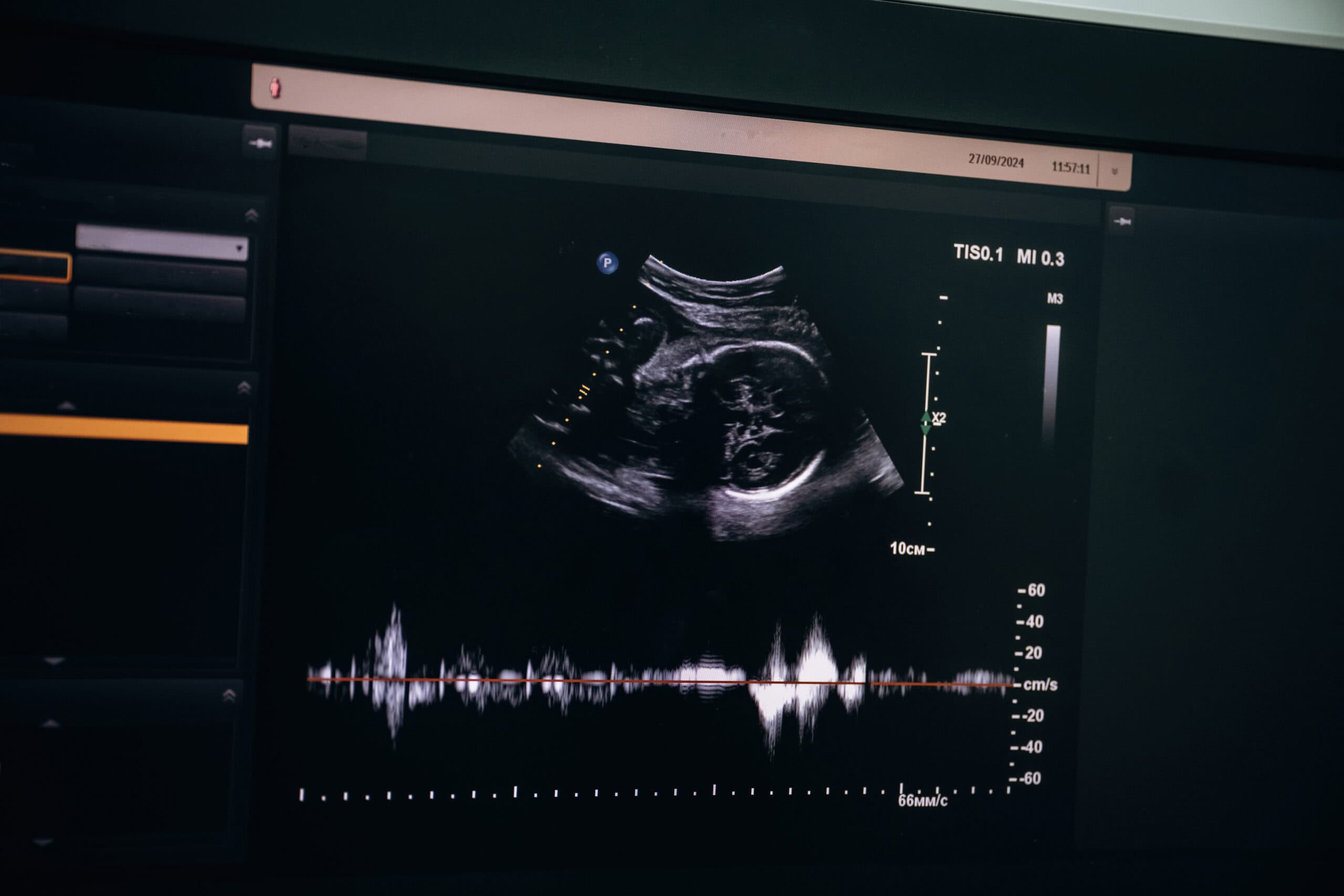 Perfil biofísico fetal en Santo Domingo