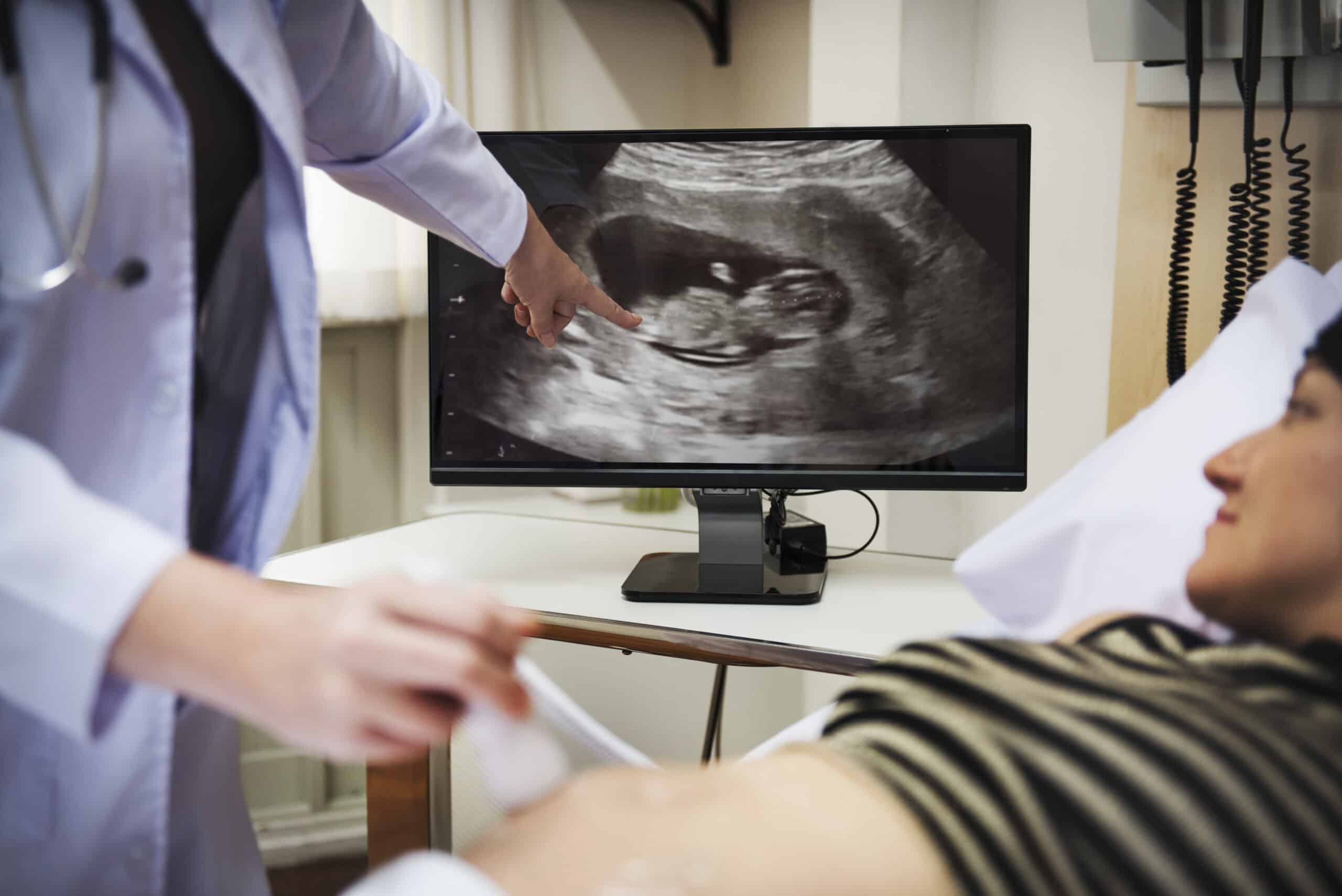 Sonografía morfológica fetal en Santo Domingo