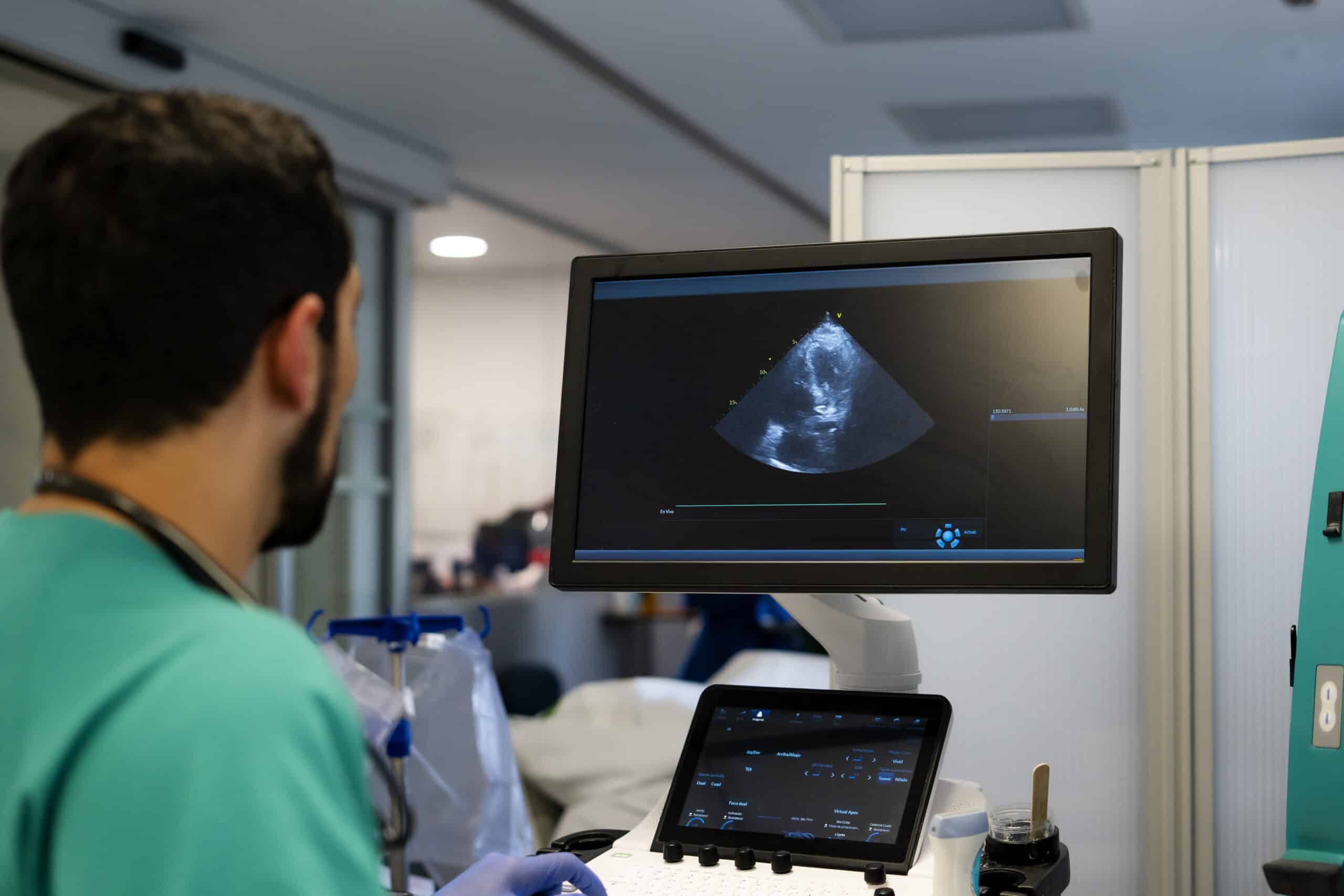 Equipo de ecocardiografía mostrando imágenes del corazón durante un ecocardiograma en RADNET